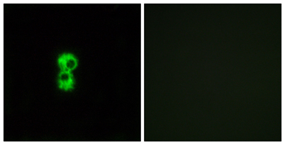 Immunofluorescence analysis of MCF7 cells, using OR1D4/5 Antibody. The picture on the right is blocked with the synthesized peptide. Immunofluorescence analysis of MCF7 cells, using OR1D4/5 Antibody. The picture on the right is blocked with the synthesized peptide.