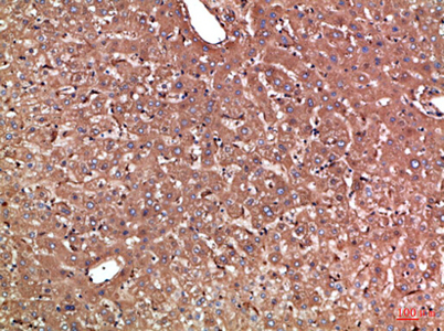 Immunohistochemical analysis of paraffin-embedded Human-liver, antibody was diluted at 1:100 Immunohistochemical analysis of paraffin-embedded Human-liver, antibody was diluted at 1:100