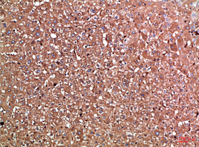 Immunohistochemical analysis of paraffin-embedded Human-liver, antibody was diluted at 1:100 Immunohistochemical analysis of paraffin-embedded Human-liver, antibody was diluted at 1:100